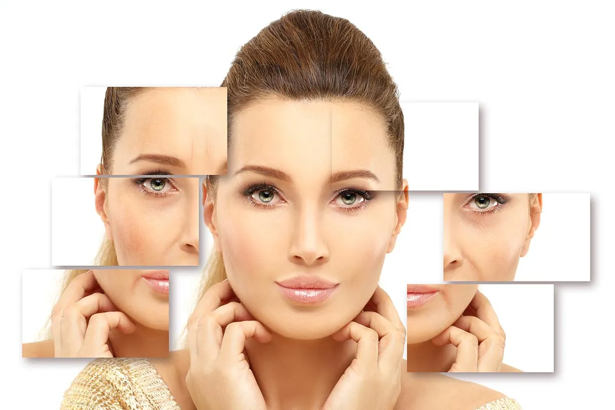 Trending FAQs About Botox Treatment