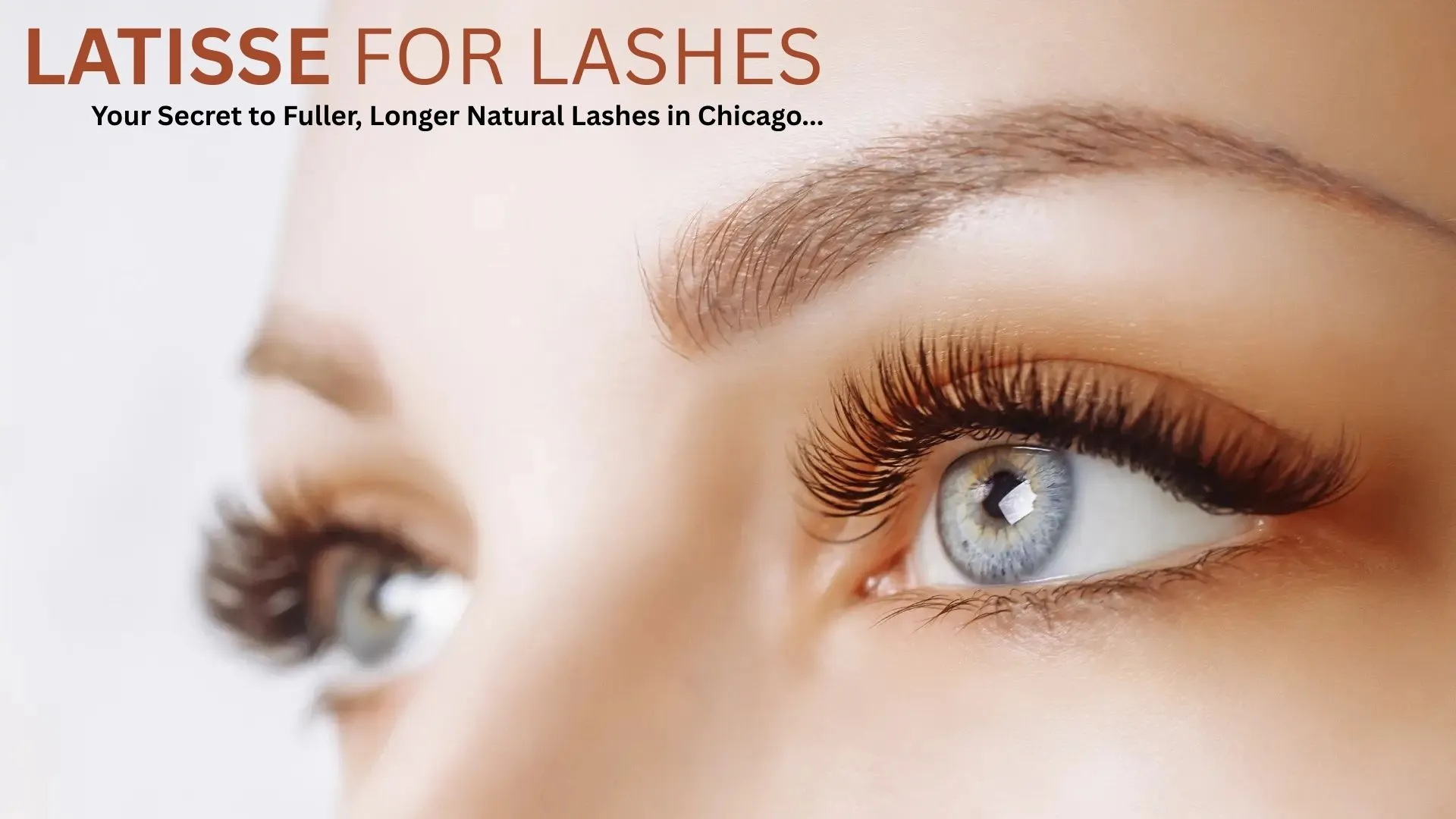 Latisse for Lashes: Your Secret to Fuller, Longer Natural Lashes in Chicago