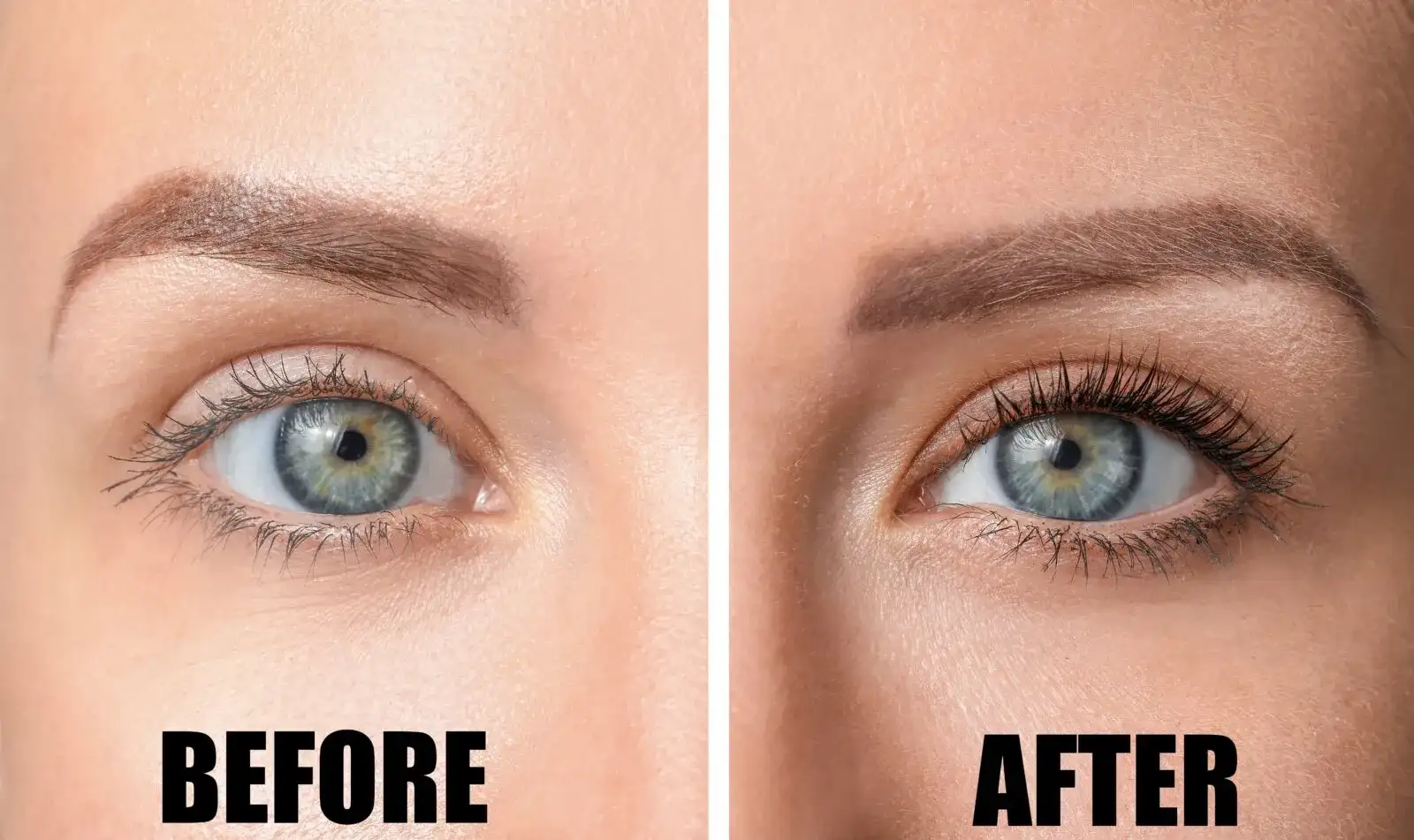 Why Choose Gold Coast Med Spa for Latisse in Chicago?