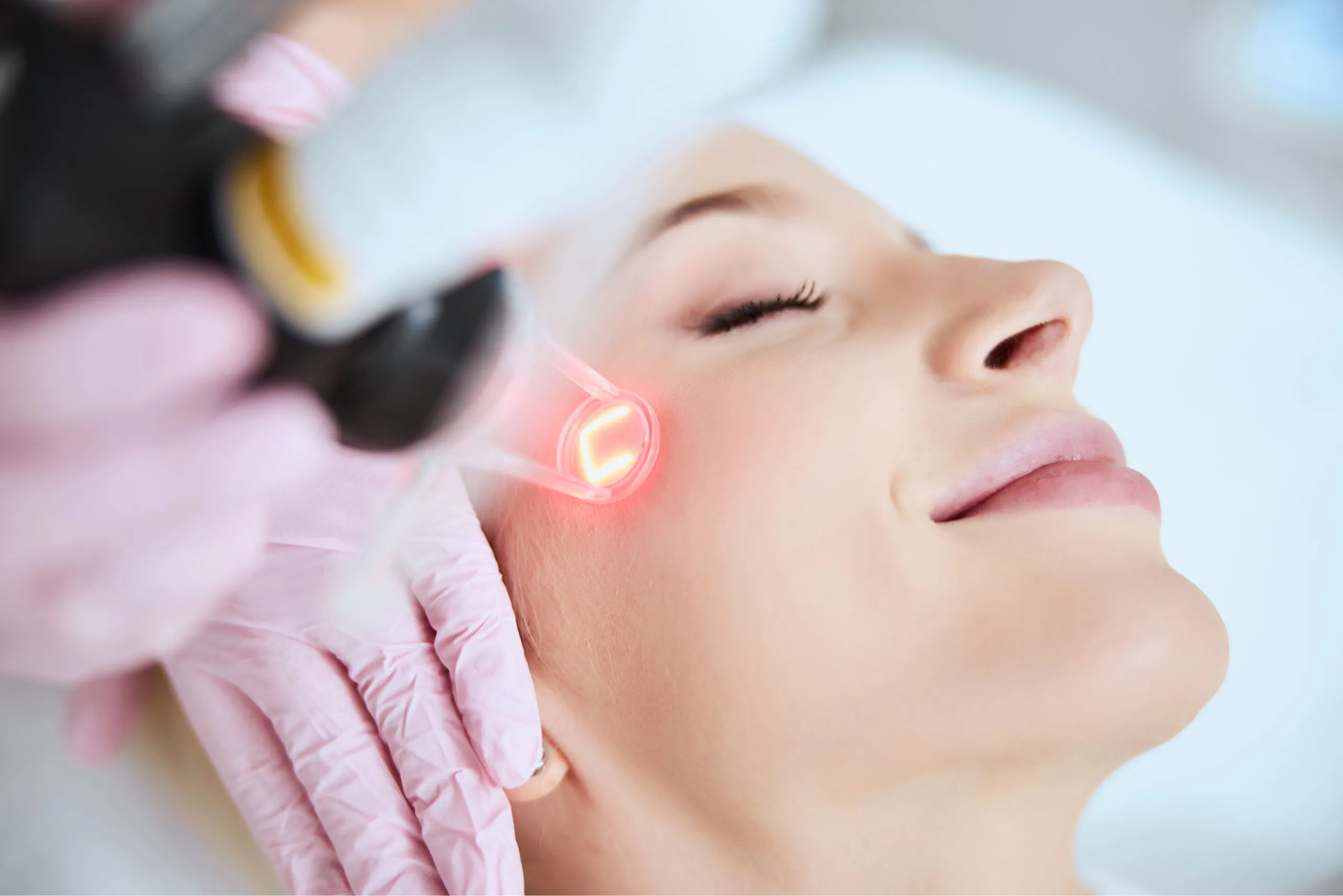 The Time for Laser Skin Renewal Is Now