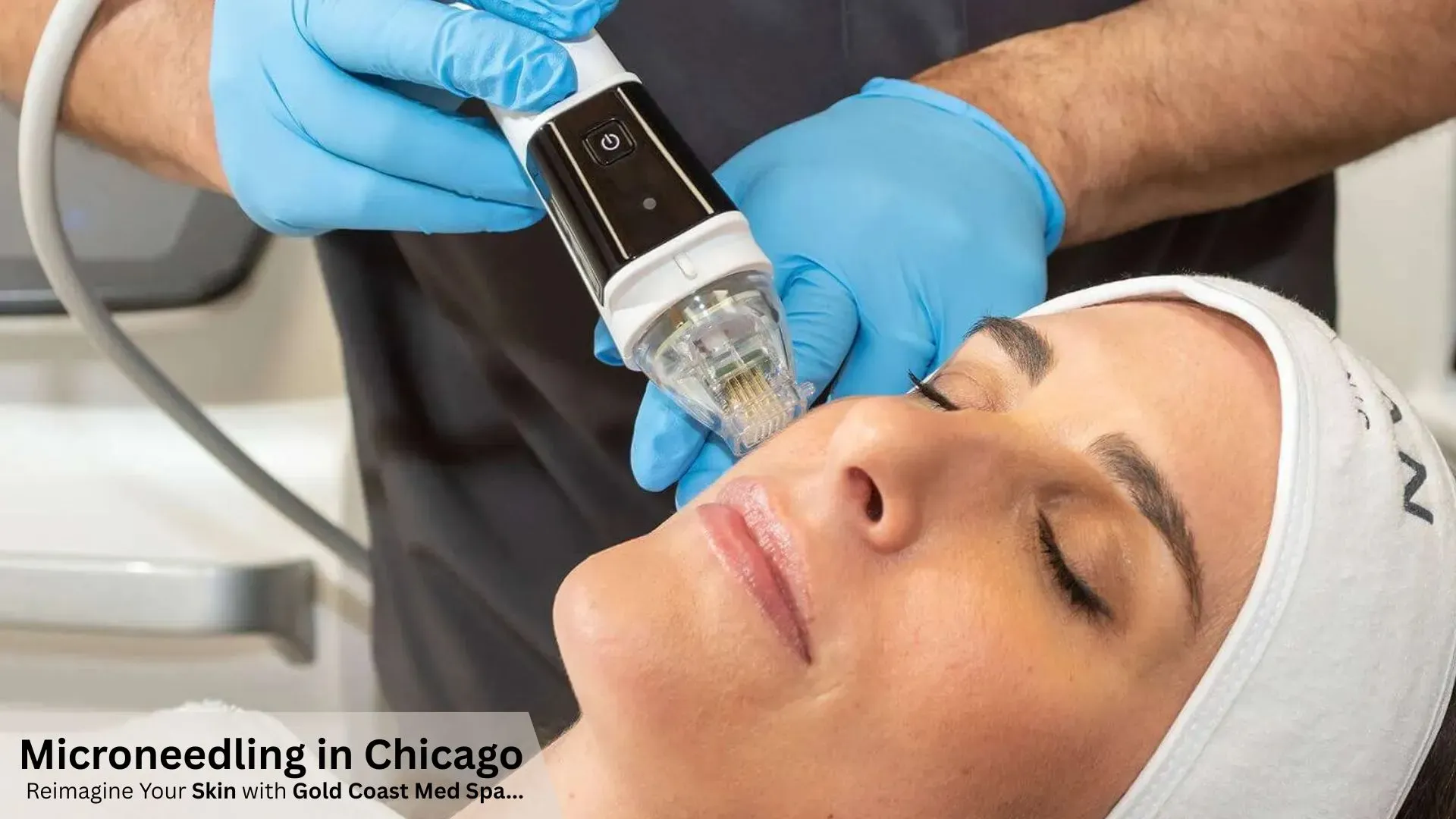 Microneedling in Chicago: Reimagine Your Skin with Gold Coast Med Spa