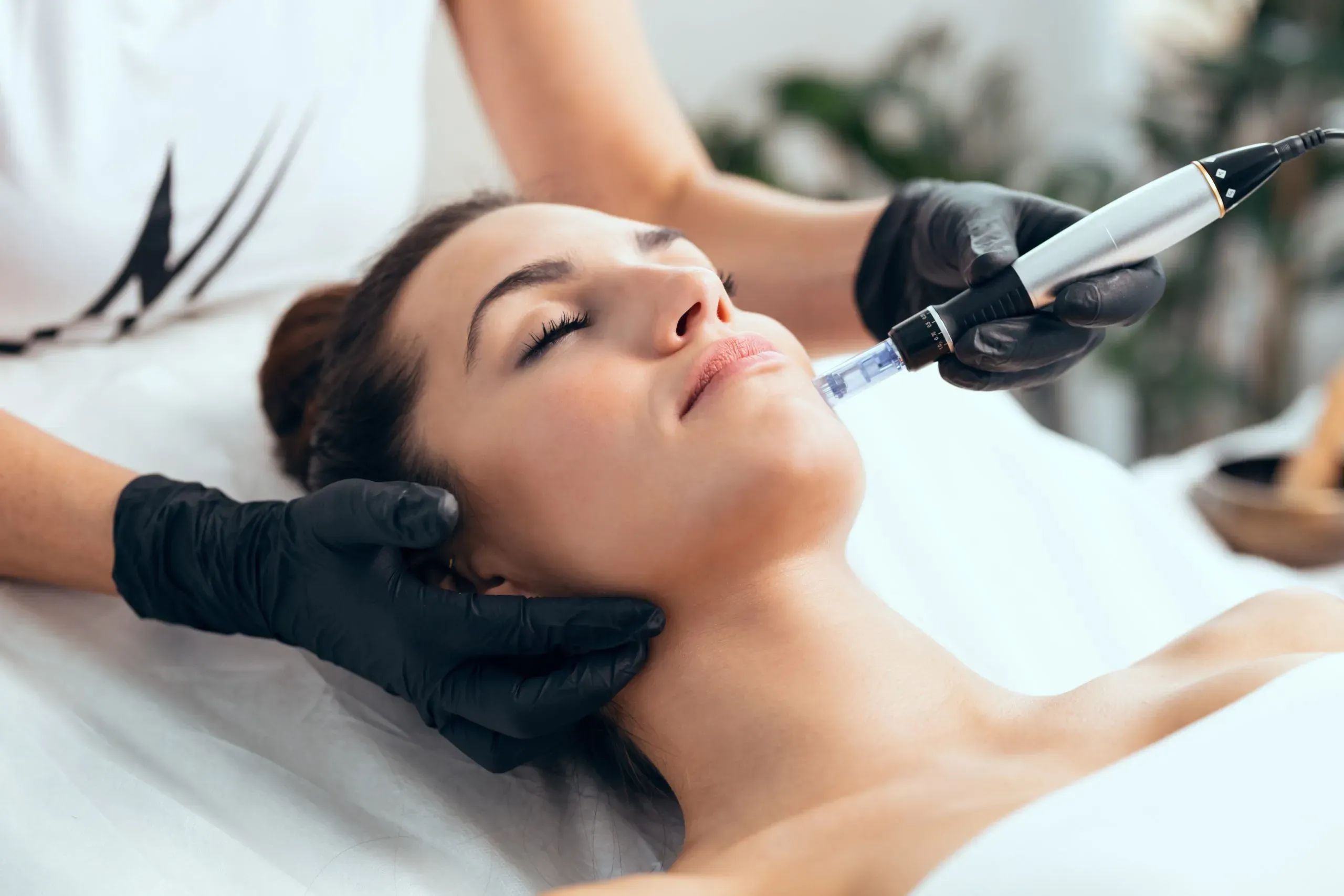 Why Choose Gold Coast Med Spa for Microneedling in Chicago?