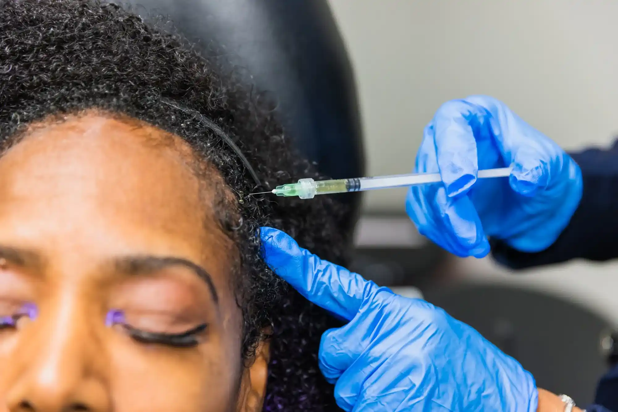 PRP Therapy & Injection Services at Gold Coast Med Spa